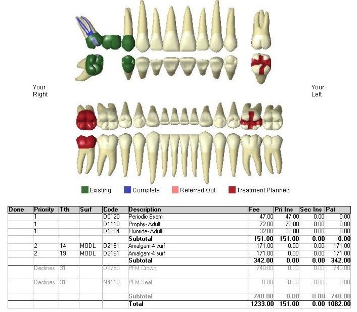 Dental Treatment Plan | SPRING ORCHID DENTAL