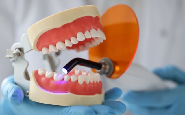 Dental Inlays And Onlays Procedure & Costs In Bassendean, Perth