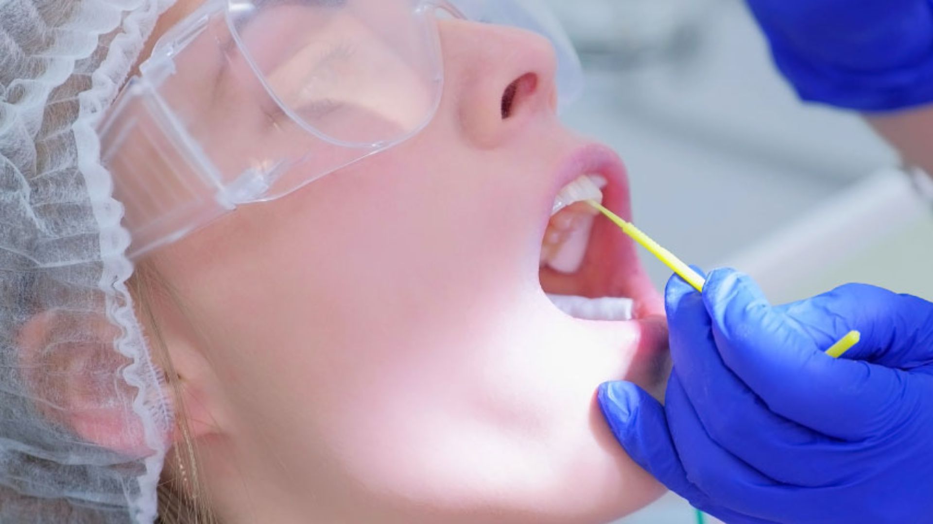 Fluoride Treatment At Spring Orchid Dental, Bassendean