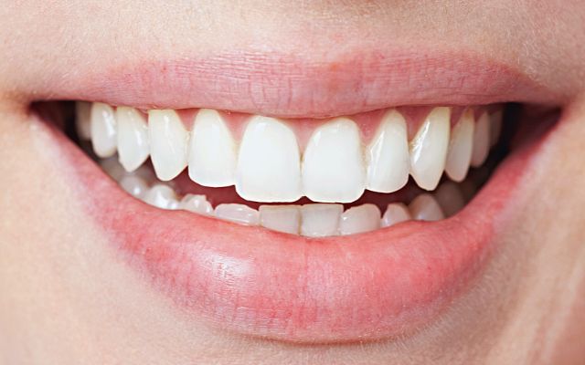 Slant Teeth: Causes, Symptoms, Treatments & Prevention