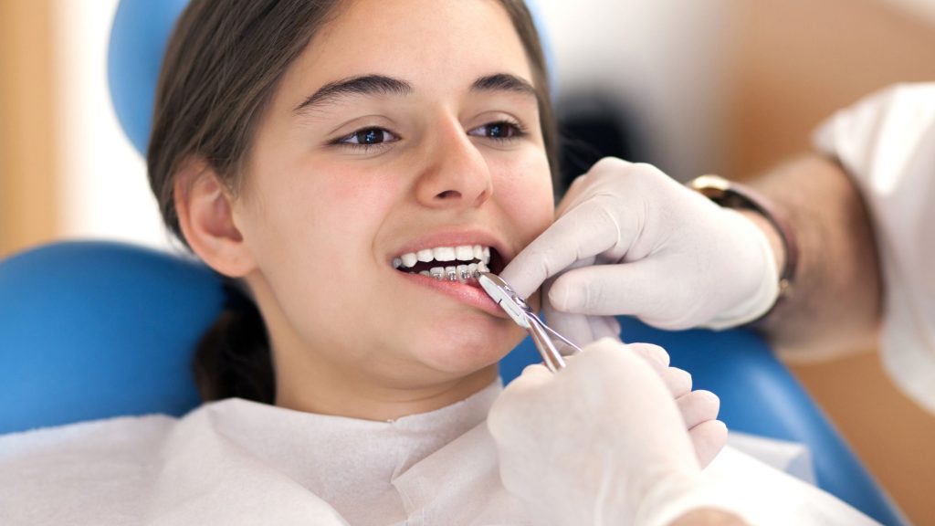 How To Put Wax On Braces? How to Handle Common Issues?