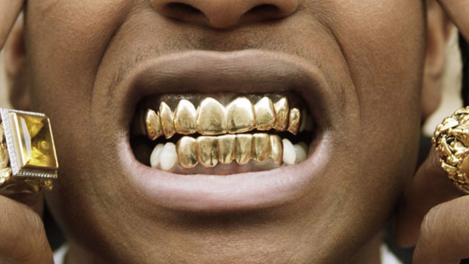 Gold Teeth: Grillz, Caps, Implants & Veneers in Bassendean