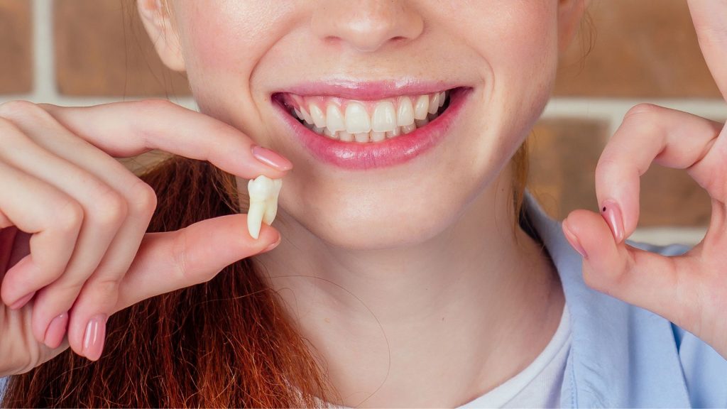 How Long Should You Wait To Exercise After Tooth Extraction?